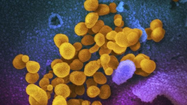 Virus capaz de sobrevivir en temperaturas de 60C