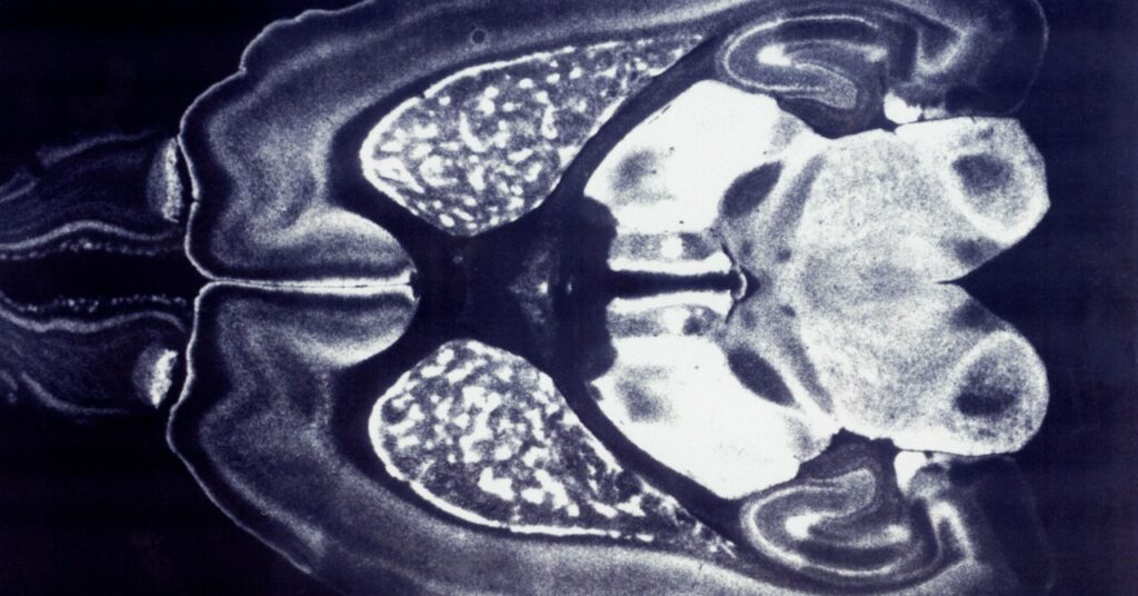 Los 'neurogranos' podrían ser las próximas interfaces cerebro-computadora