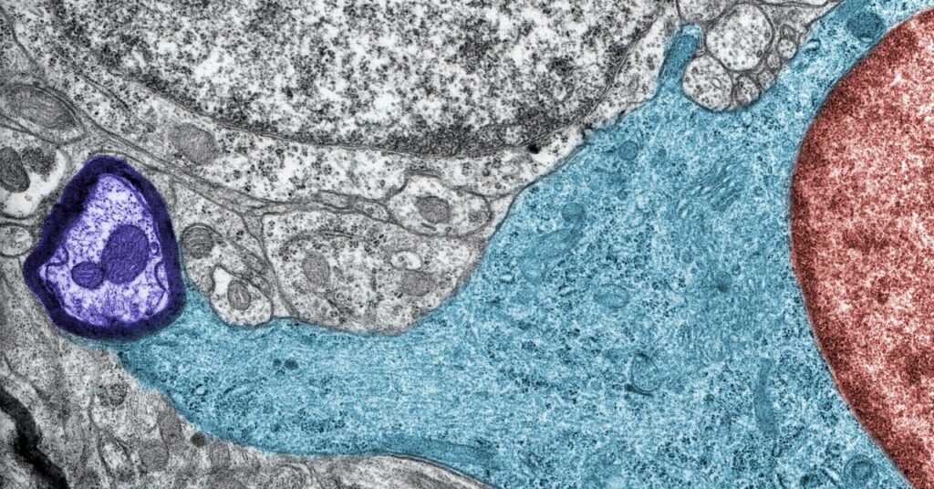 Los secretos de la 'niebla cerebral' de Covid están comenzando a disiparse