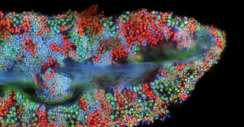 El mayor estudio del microbioma arroja nueva luz sobre los riesgos de salud compartidos